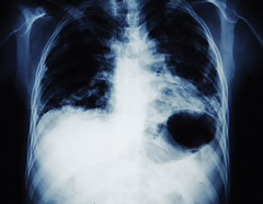 Image of an X-Ray