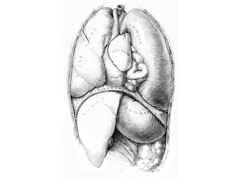This unfinished sketch of a diaphragmatic hernia shows Maria Wishart’s draftsmanship and working process. Illustration: Maria Torrence Wishart