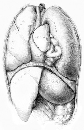 This unfinished sketch of a diaphragmatic hernia shows Maria Wishart’s draftsmanship and working process. Illustration: Maria Torrence Wishart