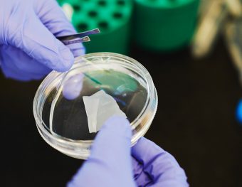 Gloved hands holding a petri dish with a cardiac tissue patch