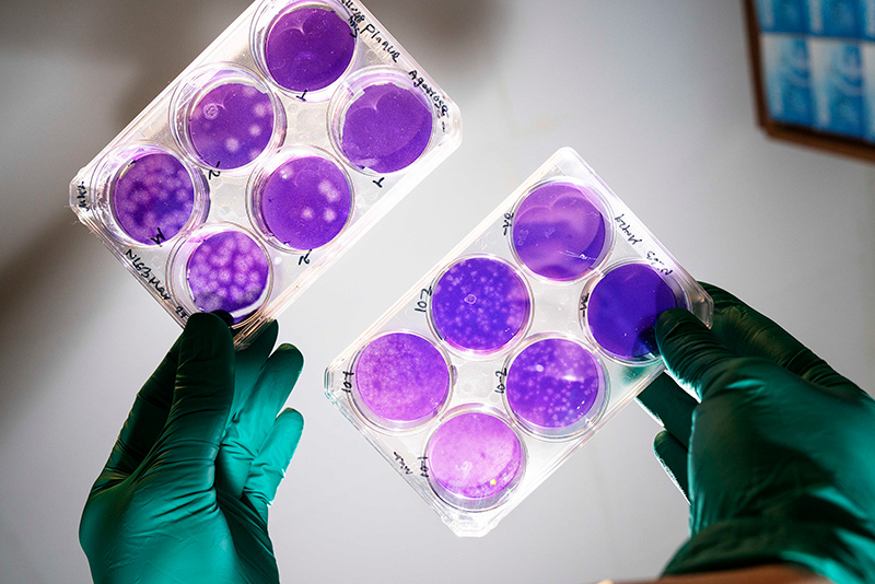 A pair of gloved hands holding a set of six petri dishes in each hand, each containing different distributions of cell cultures