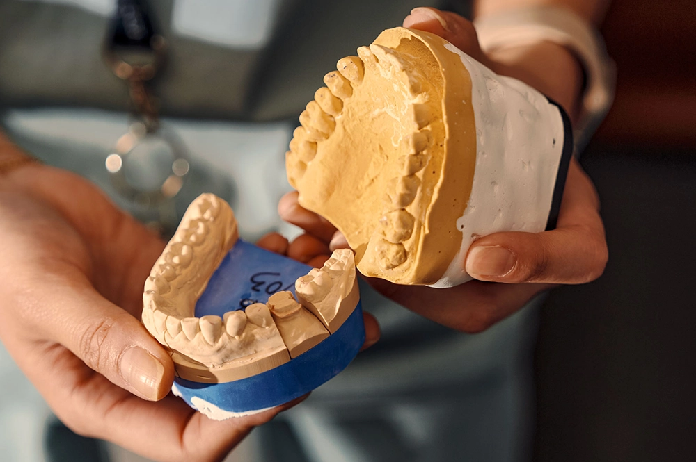Close up of a pair of hands each holding out a dental cast of a person's teeth and gums
